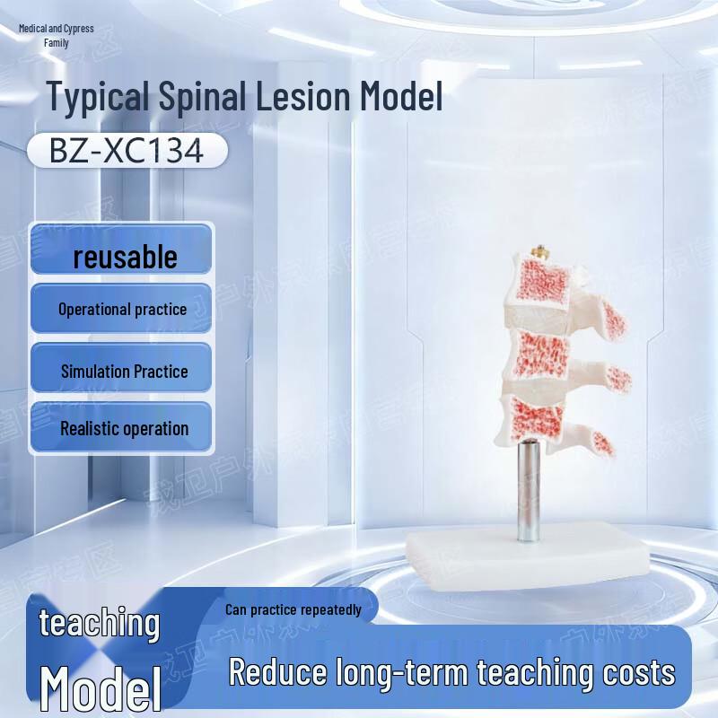 Yibaike Realistic Spinal Lesion Model