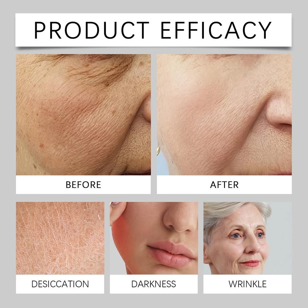 Hoygi Bee Venom Moisturizing Cream For Hydration And Wrinkle Reduction 100g