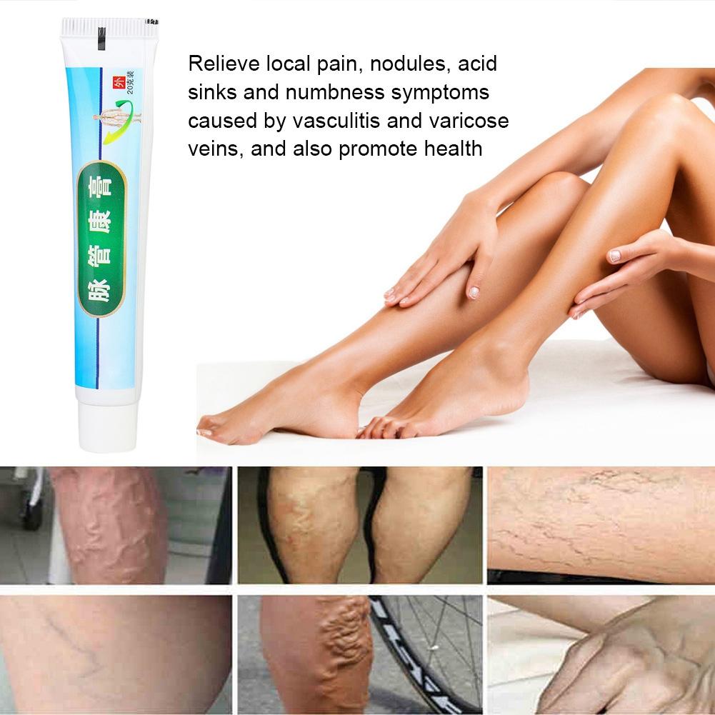 Varicose Vascular Inflammation Massage Cream Treatment Varicose Vein Ointment