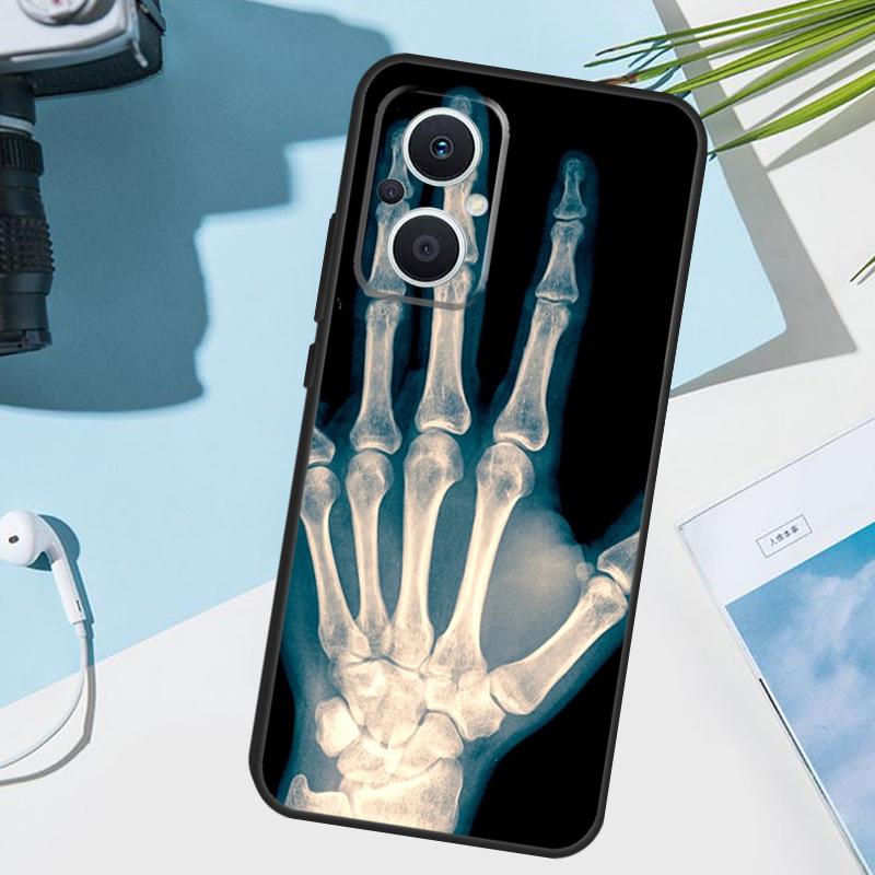 Skeleton Art Cover For OPPO Reno 13 F 10 11 12 14 Pro 11F 12F 14F 7 8 Lite OPPO Find X9 X8 X5 X6 Pro Case