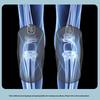HEZHENG Knee Massager CN plug (adapter included)