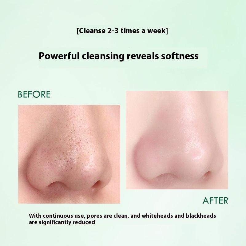 Ice Crystal Cleansing Gel Cleansing Cream for Face Blackening Discharge Black Toxins Blackhead Acne Shrinking Pores for Beauty