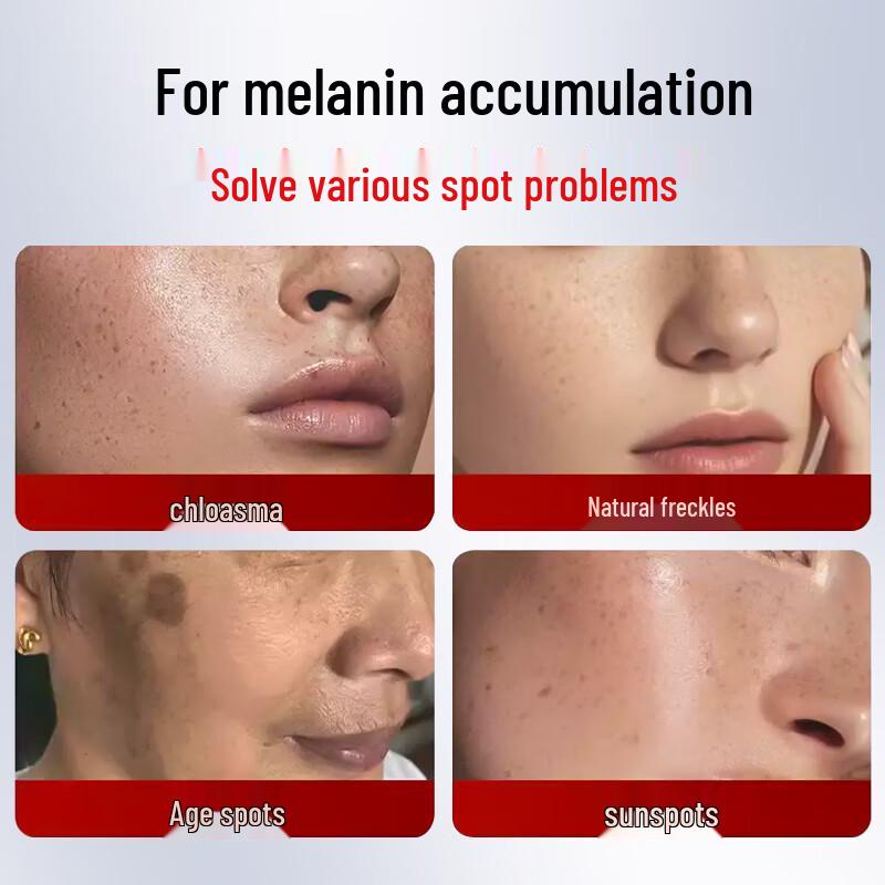 BAILUHUI 577 Niacinamide Brightening Spot Cream