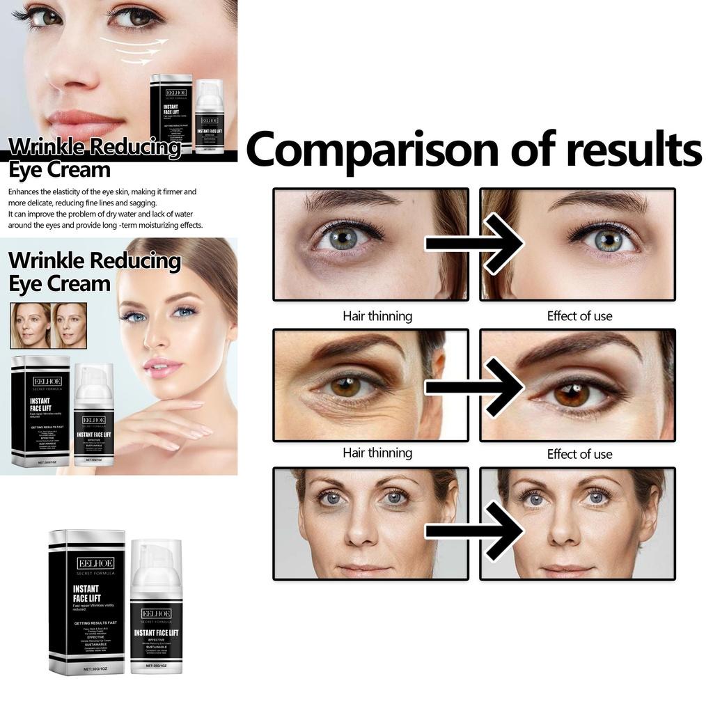 Eelhoe Eye Firming Cream Anti Aging Formula For Dark Circles And Wrinkles 30g