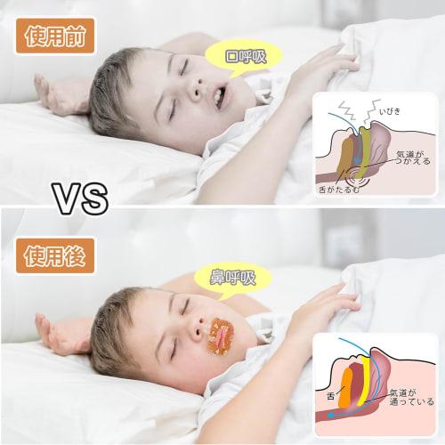 Mouth Closure Tape for Kids, Prevents Mouth Breathing, Helps Prevent Adenoid Face, Prevents Dry Throat, Promotes Nasal Breathing, Improves Sleep, and