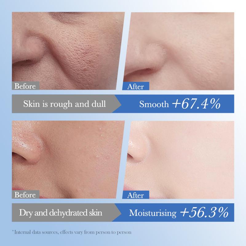 Sadoer Premium Hyaluronsäure Feuchtigkeitscreme Gegen Falten Und Für Feuchtigkeit 100ml