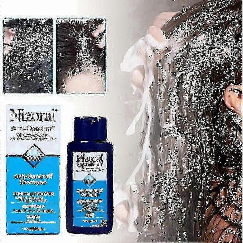2025 Anti Dandruff Shampoo Nizoral 7 Fl Oz 200ml EXP