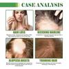 Revitalizing Hair Care Oil with Ginger, Rosemary & Ginseng  Nourish, Strengthen, Promote Hair Growth, Reduce Hair Loss & Enhance Shine for Healthy, Vi