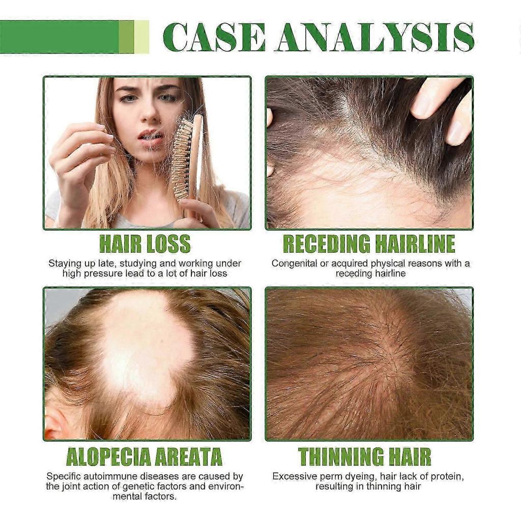 Revitalizing Hair Care Oil with Ginger, Rosemary & Ginseng Nourish, Strengthen, Promote Hair Growth, Reduce Hair Loss & Enhance Shine for Healthy, Vi