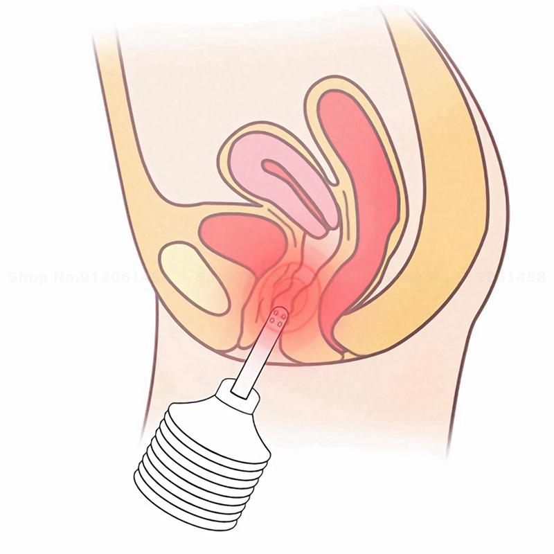 180ML Clismă Cleaner Jucării sexy pentru bărbați Full Girl Anal Plug Instrumente sexy Jucării pentru adulți Jucării sexuale pentru femei