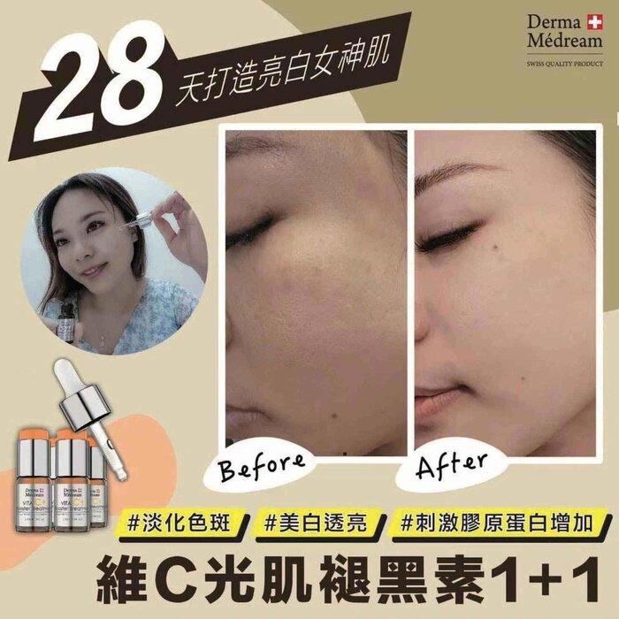 Derma Medream Vita C Booster Treatment Serum (Whitening, Acne Marks, Sensitive, Antioxidant, Pore Minimizing, Firming, Brightening) Dm043