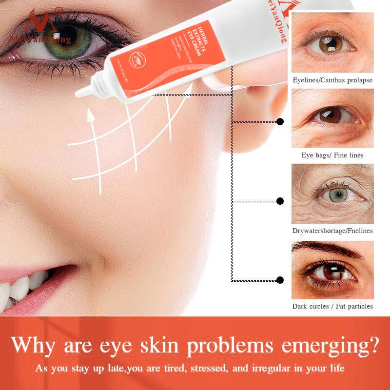 Herbal Probiotic Eye Cream Anti Wrinkle Remover Dark Circles Eye Essence Anti Aging