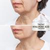 Fairy Lady Cream Neck Texture Repair Wrinkle Moisturizing Smooth T Neck Care Neck Wrinkle Cream