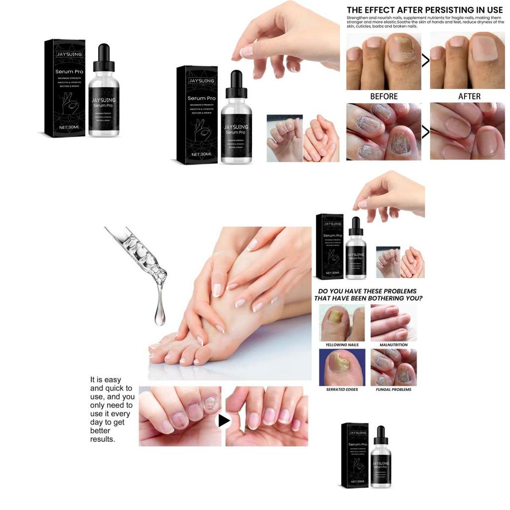 Nourishing Jaysuing Nail Repair Essence For Healthy Strong Nails 30ml