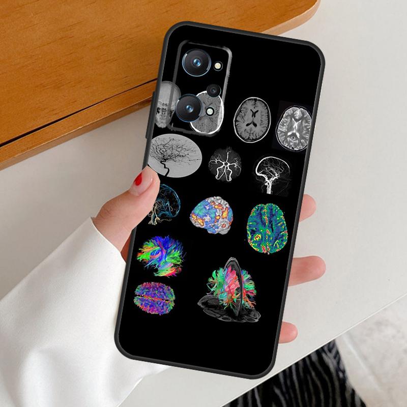 Anatomy Brain For Realme GT7 GT6 15 Pro 10 11 12 13 14 Pro Plus C65 C63 C61 C55 C51 C53 C35 C75 C67 Case