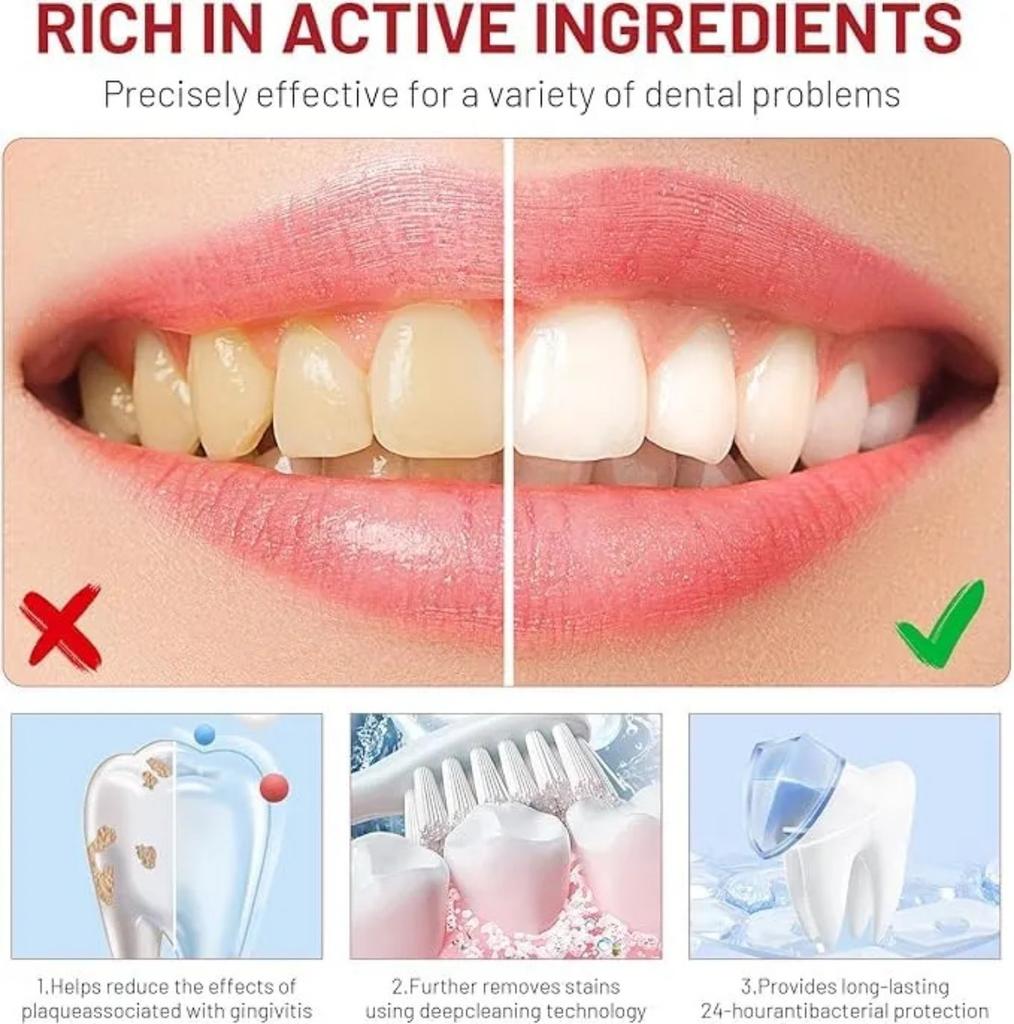 SP-8 Probiotic Brightening Toothpaste 120g, Super Probiotic-8 Oral Toothpaste, Clean Teeth & Remove Surface Stains, Daily Oral Hygiene Care