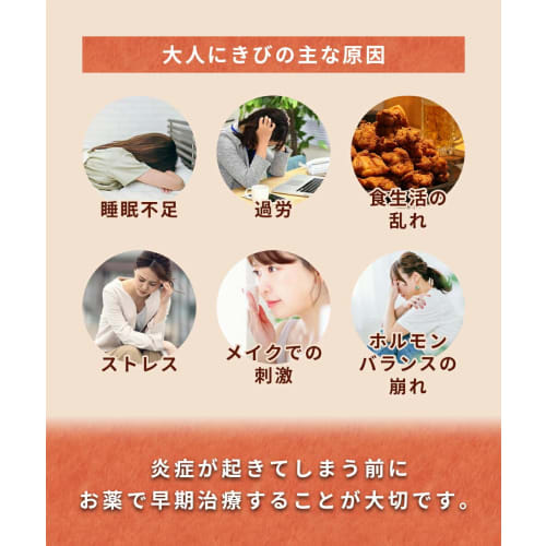 [Category 2 OTC drug] Lauma Acne Cream 18g