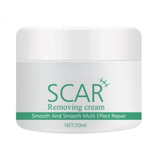 Natürliche Extrakt-Pflanzen-Akne-Stretch-Narben-Entfernungscremes für Sie