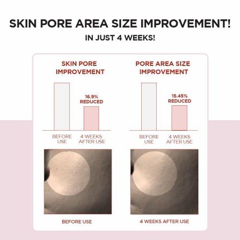 [SKIN1004] *TIMEDEAL* Madagascar Centella Poremizing Fresh Ampoule 100ml