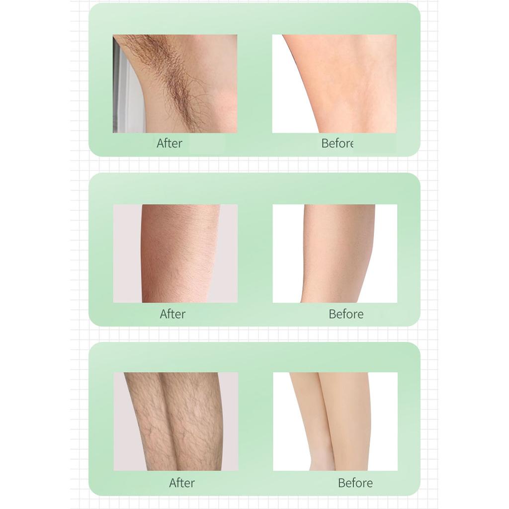 IPL Hair Remover Machine 990000 Flashes 5 Levels Adjustable Delayed Growth Ergonomic Hair Removal