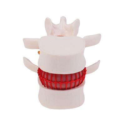Human Anatomy Skeleton Spine Lumbar Disc Herniation Teaching Model Brain Skull Traumatic School Supplies Medical Instrument