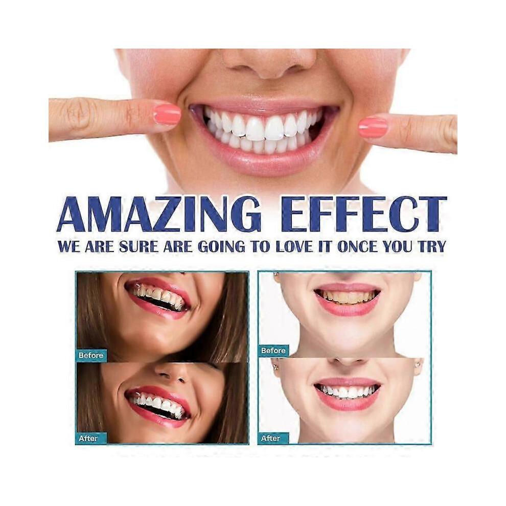 3Pcs DentiZen Gum Therapy Gel Gum Instant Soothing Gels for Sensitive Teeth Pen 4ml