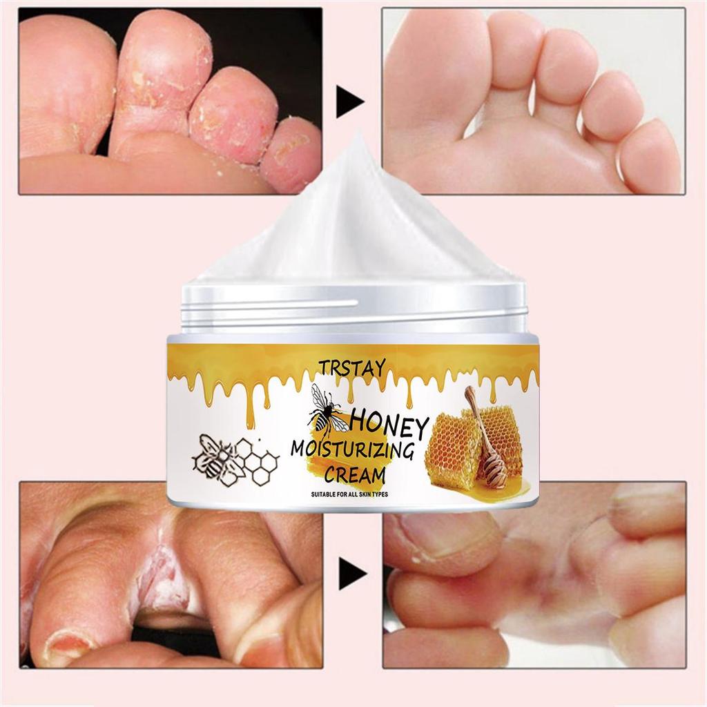 Chapped Hands and Feet Repair Cream, Moisturize, Nourish the Skin, and Leave the Skin Soft and Delicate