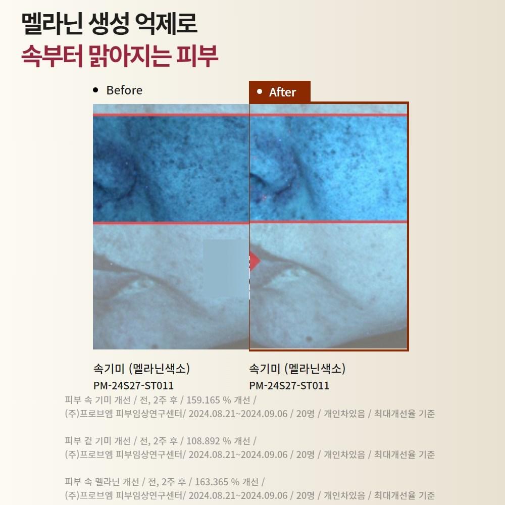 Wizard Choseon Yeast Balm Tranexamic Acid Pharmacy Blemish Cream Large-capacity Blemish Cream, 100ml, 1 Unit