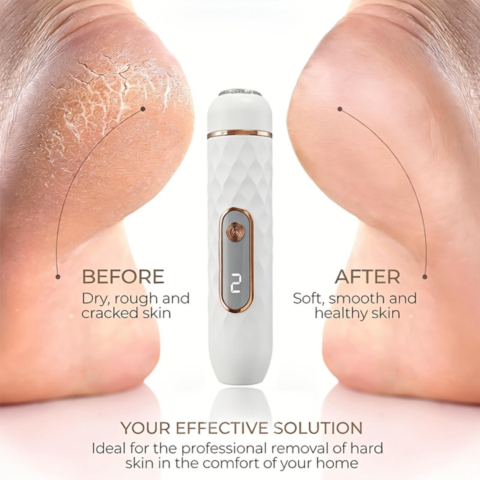 

Household Electric Foot Grinder For Removing Dead Skin From The Feet Charging Model One Size білий