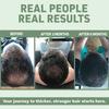 Biotin Supplement, Containing Kelp Blend, Supports Hair Health, Suitable for Adults.