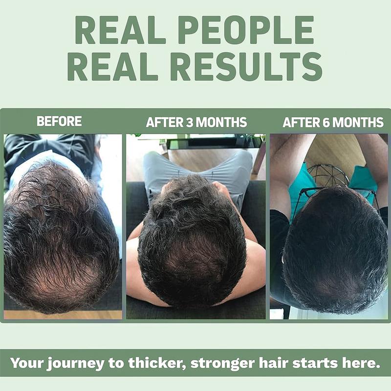 Biotin Supplement, Containing Kelp Blend, Supports Hair Health, Suitable for Adults.