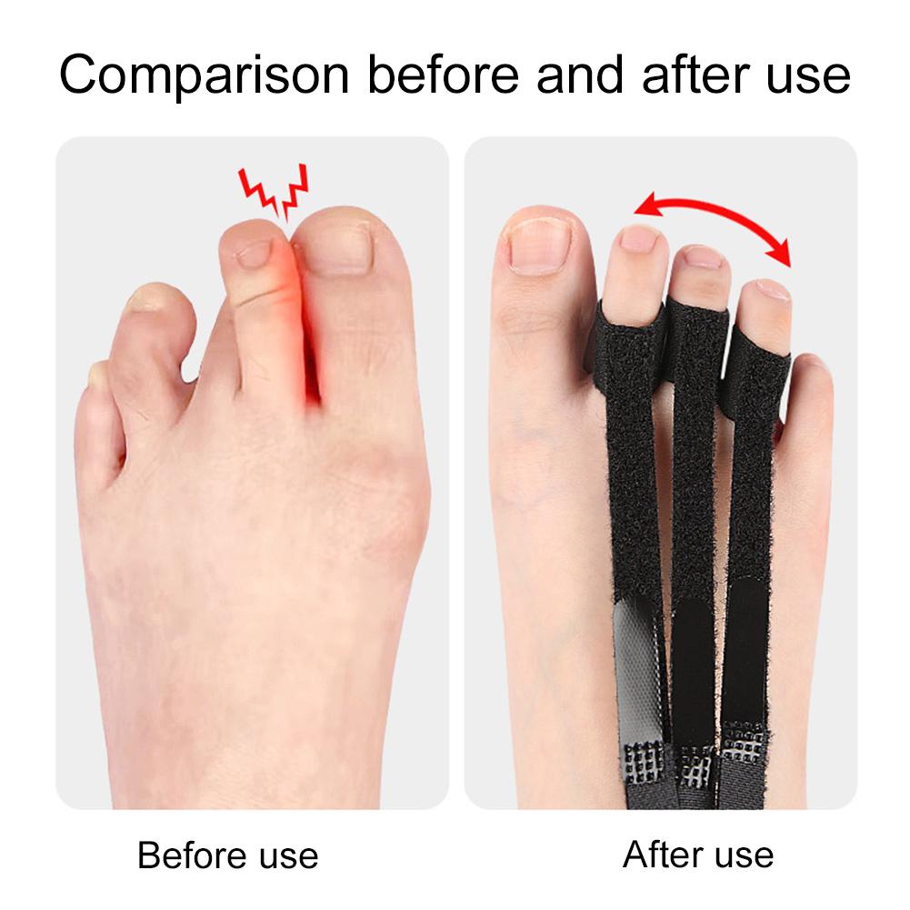 

Toe Separator Adjustable Overlap Toe Adjustment Tool Protective Toe Spacer Toe Overlap Corrector for Foot Care China Mainland