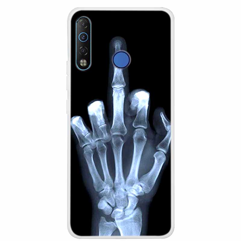 Voor TECNO Camon 12 Hoesje Camon 12 Air Bumper Siliconen TPU Zachte Telefoonhoes Voor TECNO Spark 4 Camon12 Hoesje Schokbestendig Coque Funda