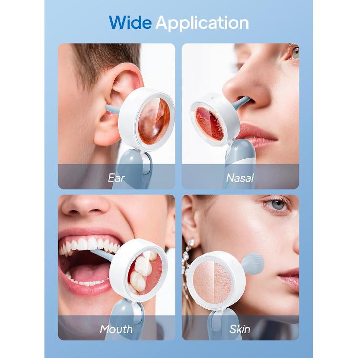 

Qimic Отоскоп Камера для ушей с 1,38 экраном, 1080P Отоскоп с 4 светодиодами, 12 силиконовых ушных воронок, Поддержка фото и видео, Просмотр на ПК, Идеальный карманный