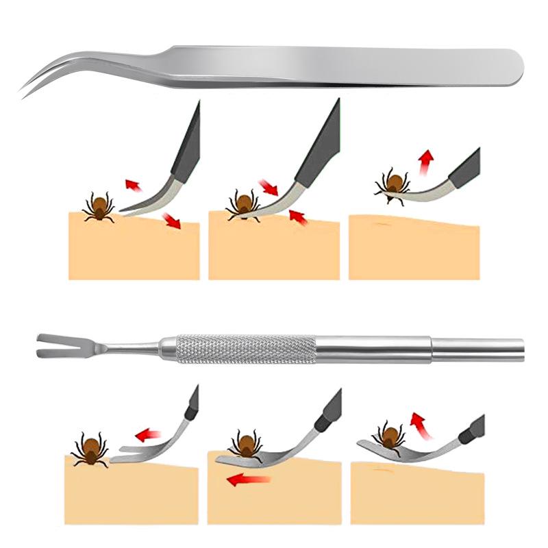 Stainless Steel Pet Grooming Set: Nail Clippers, Tick Tweezers, Lice Fork, Lice Clips for Dogs