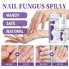 1/3/5PCS Nail Fungus Spray Reduce Beriberi Deodorize Remove Onychomycosis Paronychia Deeply Mild Cleansing Nail Care Spray