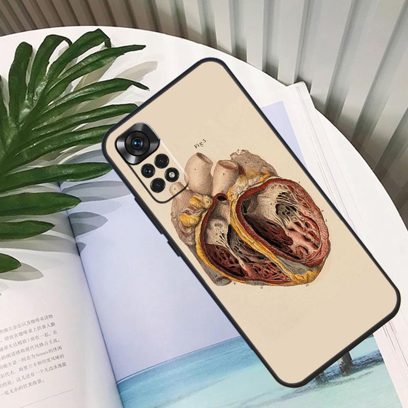 Human Anatomy Funda For Xiaomi Redmi Note 11 10 12 13 14 15 Pro Plus Case For Redmi 15C 10C 13C 12C 14C 15