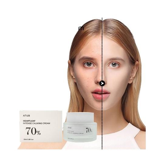Anua Birch 70 Moisture Boosting Cream | 50ml