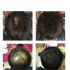 Black  Hair Loss Building Fiber Powder Hair Thickening Powder Keratin Hair Fiber Wig Extension Fiber Hair Care For Women Men
