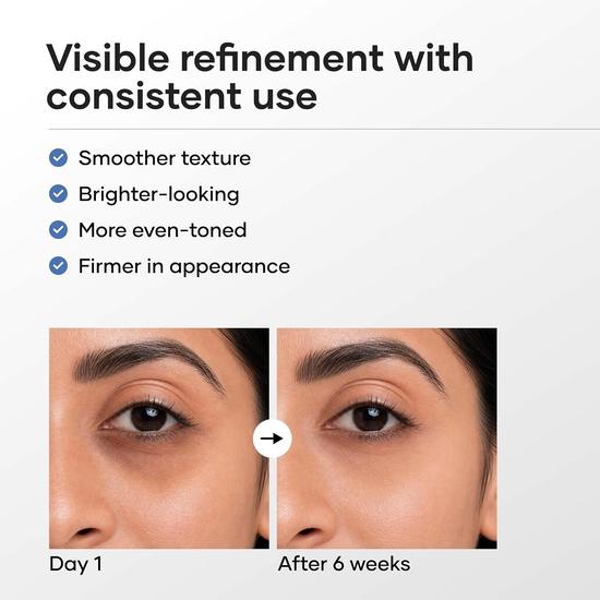 Cureskin Vitamin K + Retinol 0.1% Under Eye Cream | Reduces Dark Circles, Puffiness & Fine Lines| Night Cream for Women & Men | 15 g