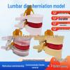 Human Lumbar Disc Protrusion Model for Spinal Pressure Demonstration and Lesion Analysis
