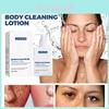Jaysuing Spot Cleanser Lotion 150ml For Deep Facial And Body Cleansing To Brighten And Fade Spots