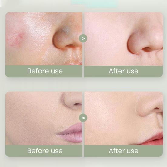 Aloe Vera Exfoliating Gel Mild & Non-irritating Face Cleanser Soothing Skin Deep Cleansing Pore Blackhead Remover Gel To Balance Water & Oil