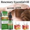 2 Pcs Rosemary Oil For Hair Growth, Rosemary Essential Oil For Hair Growth & Skin Care,improve Hair Loss