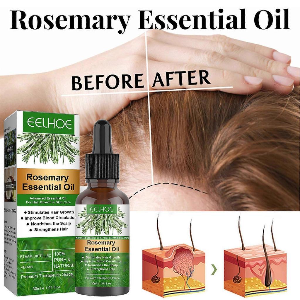 2 Pcs Rosemary Oil For Hair Growth, Rosemary Essential Oil For Hair Growth & Skin Care,improve Hair Loss