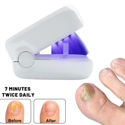 Nail Fungus Treatment Light 910nm Infrared Light 460nm Blue Light Toenail Fingernail Fungal Cleaning Onychomycosis Removal Device LED Therapy Lamp