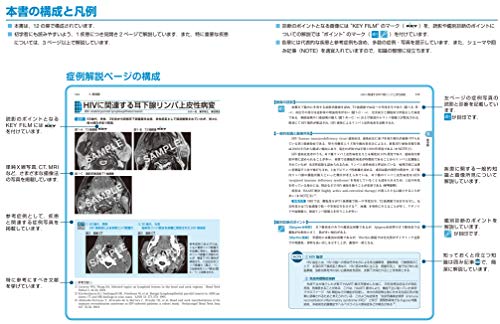 Imaging Diagnosis of the Head and Neck, Revised 2nd Edition (Image Diagnosis Special Edition KEYBOOK Series)