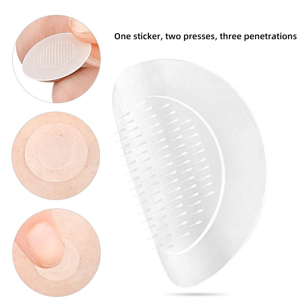 Lösliches Mikronadel-Hydrokolloid-Akne-Pflaster, wasserdicht, unsichtbar, atmungsaktiv, Akne-Pflaster, erhältlich für Tag und Nacht, Hautpflege-Reparatur-Pflaster