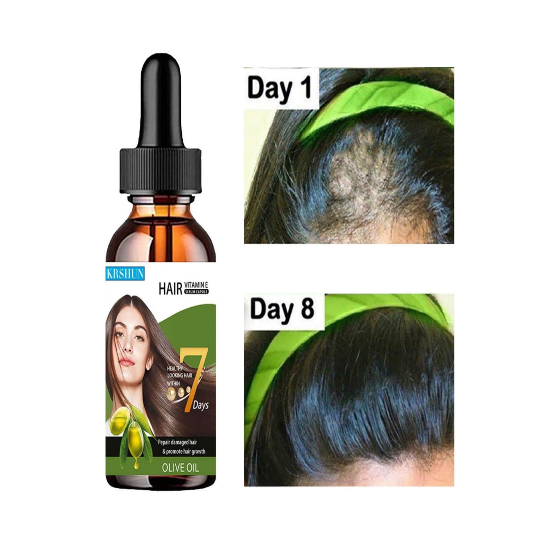 

Имбирное масло, натуральная растительная эссенция, уход за волосами кожи головы, предотвращение выпадения волос, эфирное масло, средство против выпадения волос, инструмент для ухода за волосами и красоты