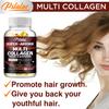 Multi Collagen Complex 1970mg 120 Capsules - 5 Types I II III V X, Beauty & Wellness